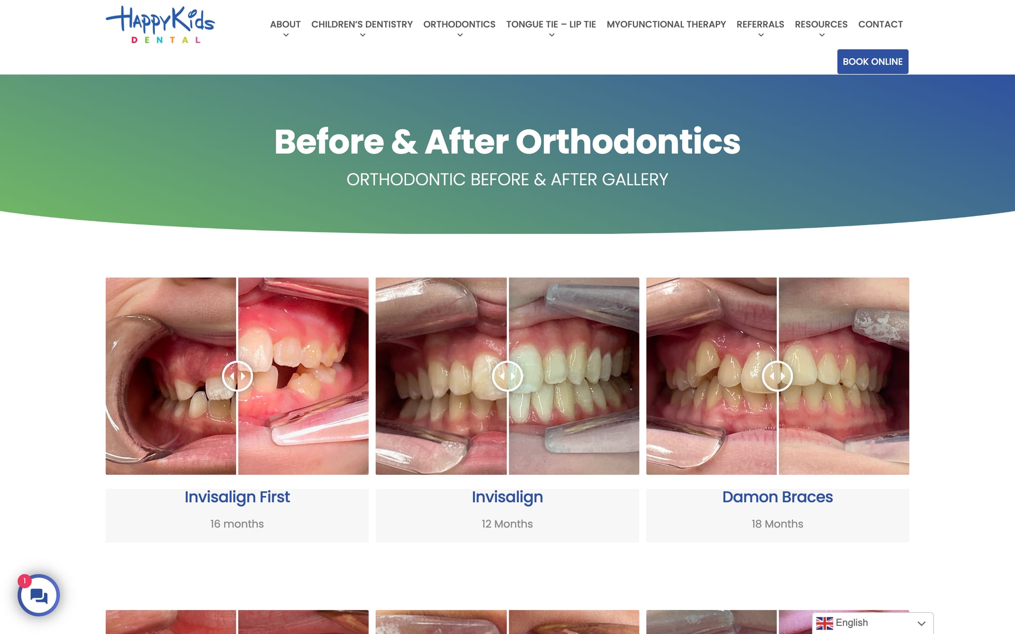 Before and after: orthodontic cases with treatment and duration.